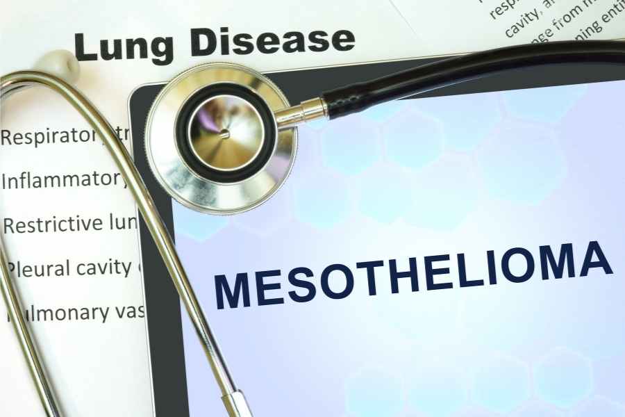 Mesothelioma lawyers nyc